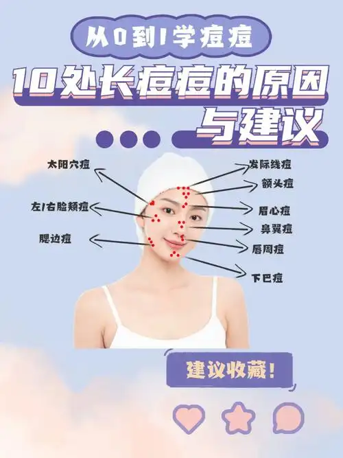 脸上不同位置长痘痘其原因是不一样的,长痘有可能是身体内部的反馈,这