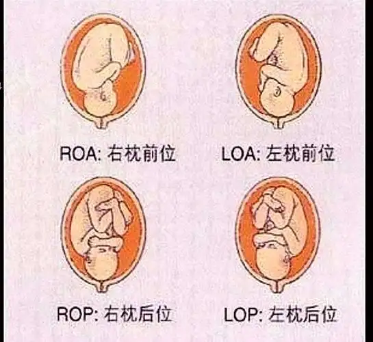 什么是胎方位示意图_有来医生