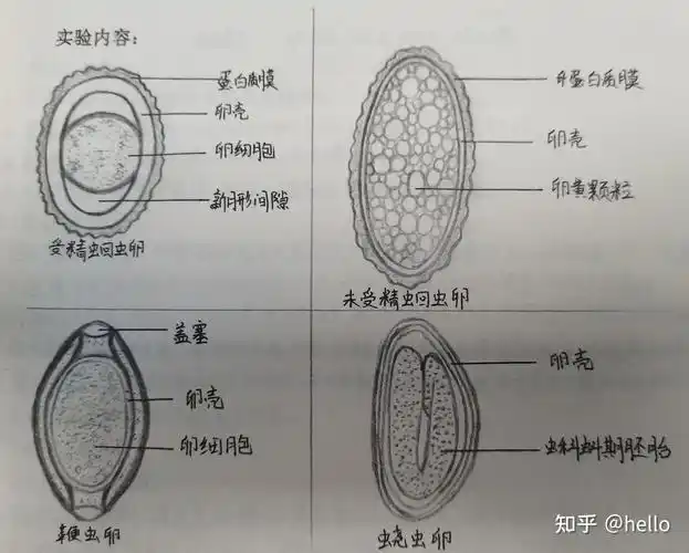 1.受精/未受精蛔虫卵,鞭虫卵,蛲虫卵