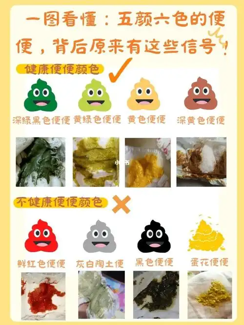 一图看懂婴儿便便颜色表75干货收藏60