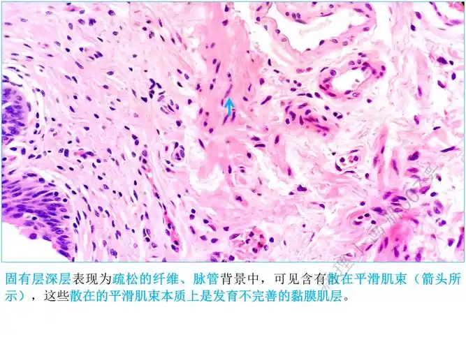 膀胱正常组织学层次