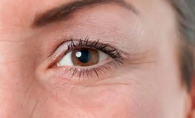 眼部皱纹怎么去除最有效果,眼周出现顽固皱纹?现在用眼霜还来得及吗?