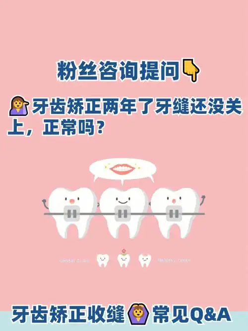 拔牙矫正两年了牙缝还没关上正常吗71