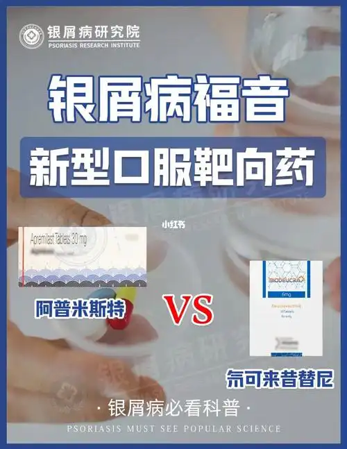 87氘可来昔替尼和阿普米斯特都是目前治疗银屑病的新型药物,同样