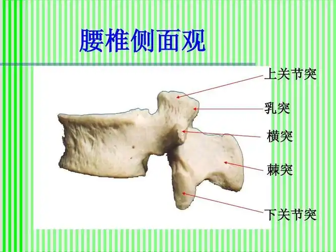 腰椎侧面观 上关节突 乳突 横突 棘突 下关节突