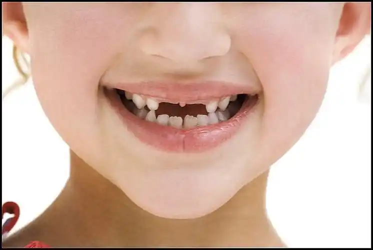 特写_孩子_微笑_正面_牙齿_高清图片_全景视觉