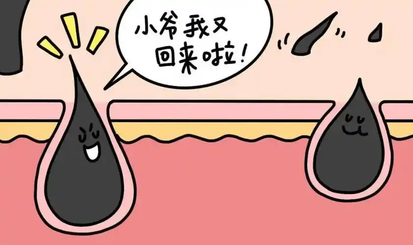 5 折抢脱毛仪!千万别错过这波新春福利_能量_比基尼