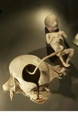 婴儿的塑化标本