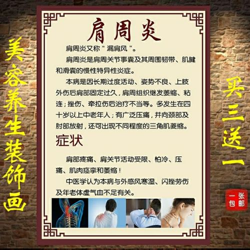 中医养生馆美容院肩颈保养肩周炎症状挂画挂图宣传海报定制kt板