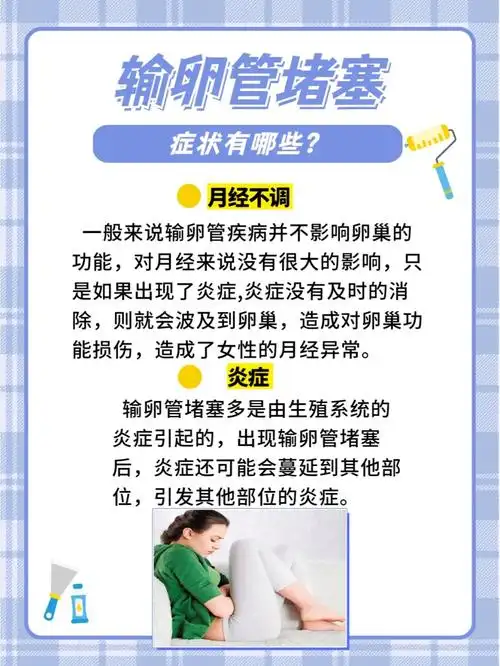 输卵管堵塞有症状提前发现好治疗