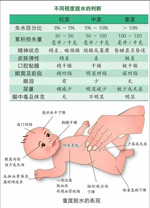 宝宝腹泻,警惕脱水