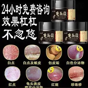包皮龟头炎霉菌性珍珠疹念珠菌阴茎瘙痒消炎治疗男性喷剂专用药膏