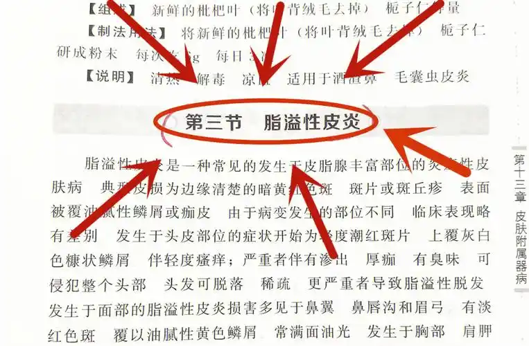 一个方子治好脂溢性皮炎三甲薬方自取