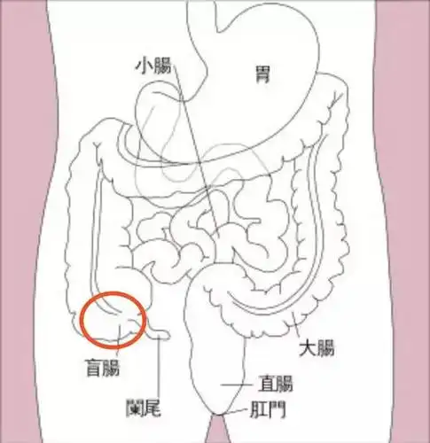 一键康:「每日"医"案」盲肠炎是阑尾炎吗?一定要开刀吗?