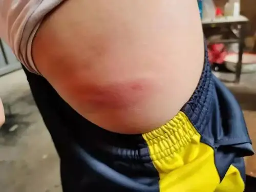 山东一小学体育老师殴打全班54名学生,家长:下手太狠了!