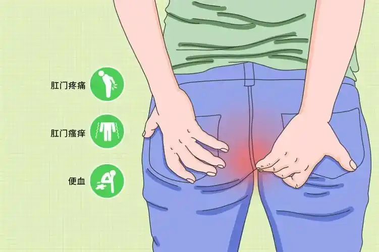 青海东大肛肠医院不想得痔疮至少要做到这几点