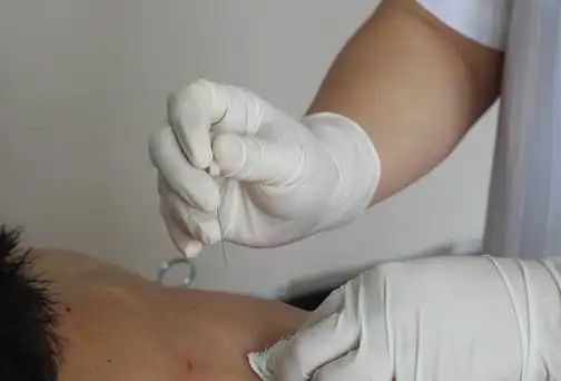 p>小针刀疗法是一种介于手术方法和非 a href="#">手术疗法 /a>之间