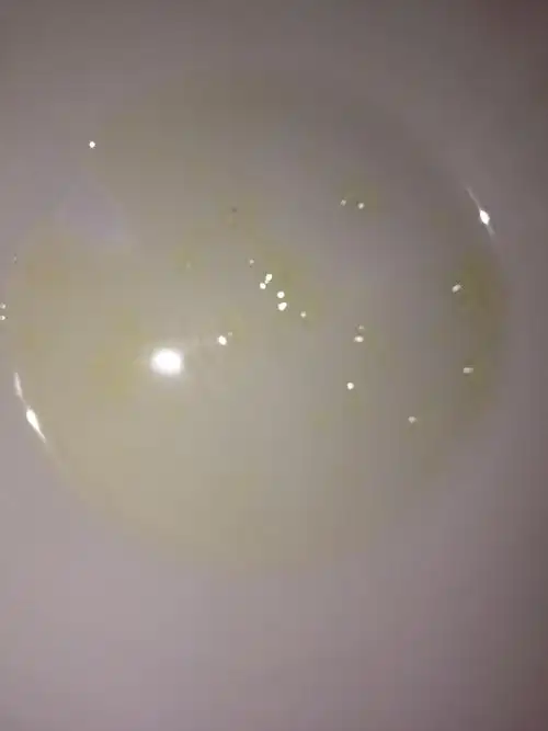 射精出来 有黄色的小果冻 这个症状 有时有有时没有 这样影响怀孕吗