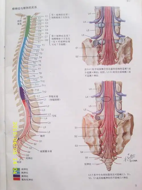 非手术治愈腰椎间盘突出症