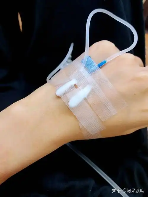 阿呆渡瓜 的想法: 多少年了没有因为小感冒而打针输液 - 知乎