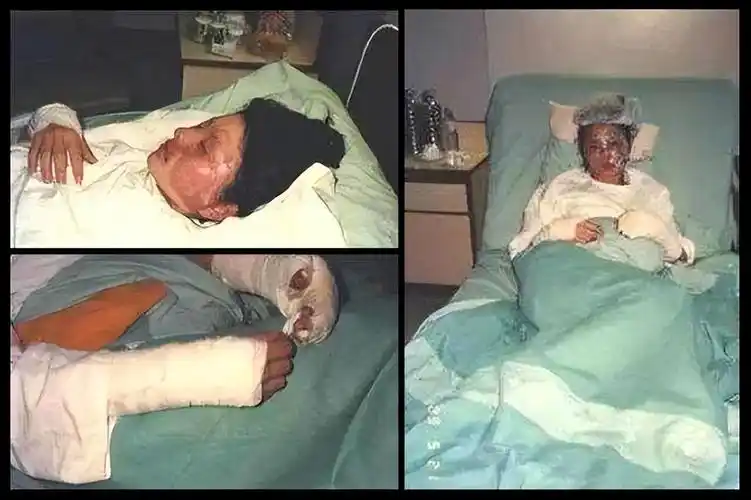 胡慧中和吕良伟也遭遇了同样的悲剧.