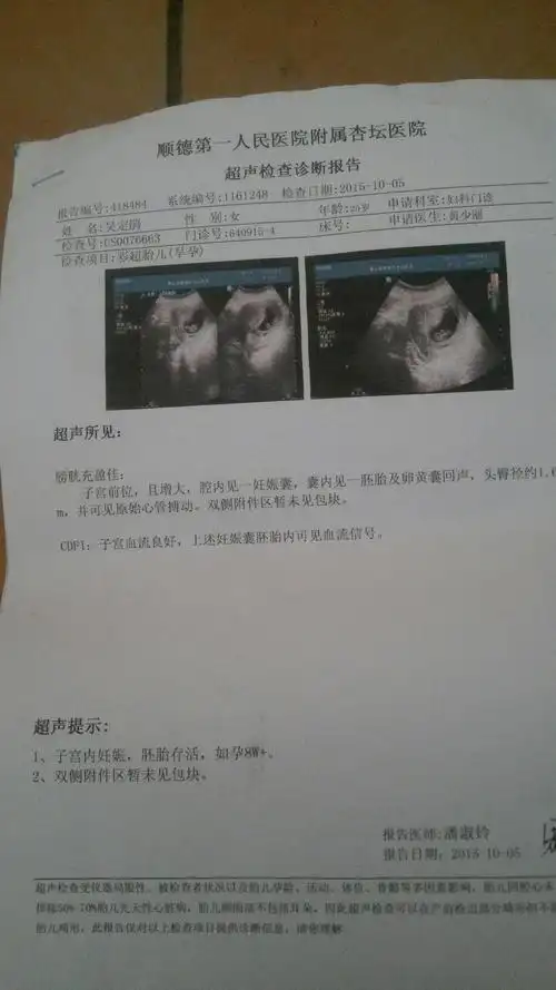 我现在怀孕两个月了.请问这个单子怎么样哦.有何我一样的宝妈.