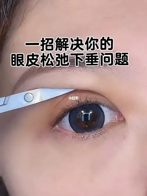 一招解决你的眼皮松弛下垂问题