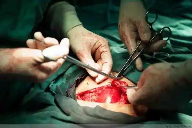 手术过程中虽然也出了不少血,但没有流个不停
