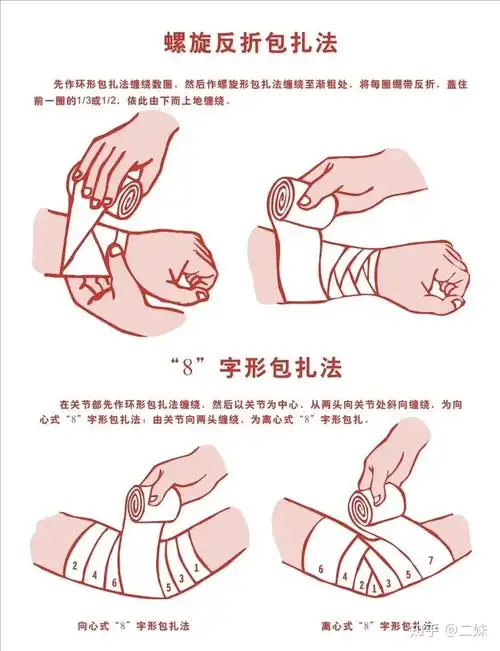 创伤之止血包扎