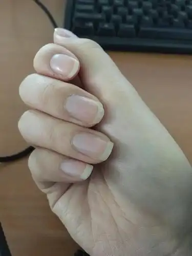 姐妹们有手指甲开裂的吗?