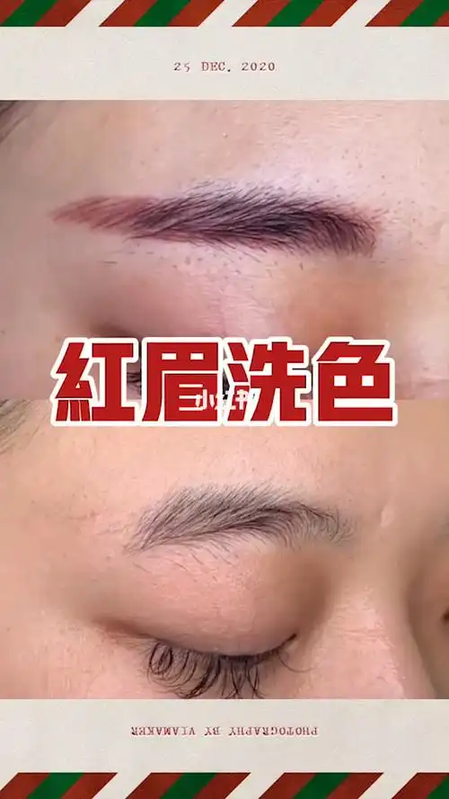 肇庆洗红眉丨无创转色丨无尴尬期不掉痂