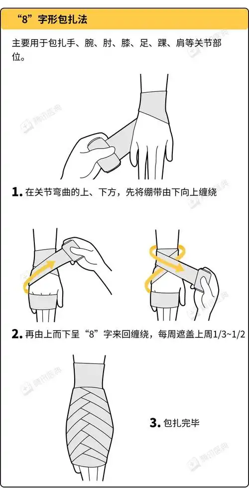 外伤处理中超实用的5种绷带包扎法,赶紧学起来