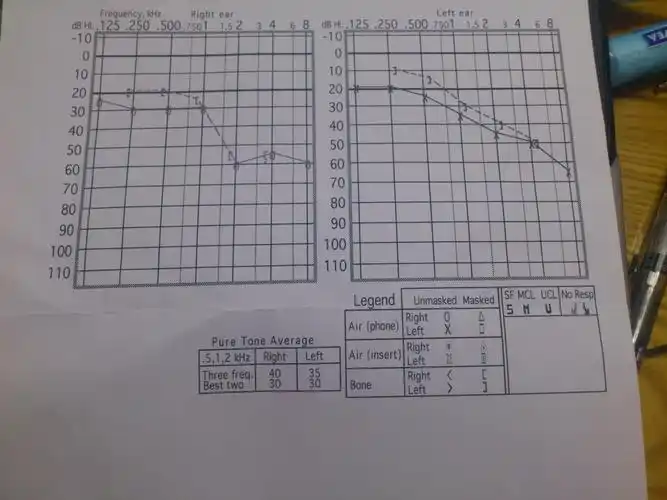 听力报告解读:如何详尽解读听力测试报告单