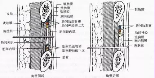 史上最全胸腔穿刺总结快收藏