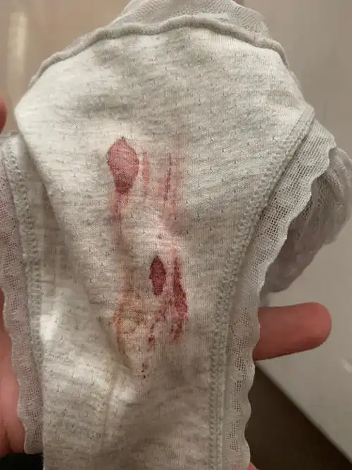 万能的姐妹们帮我看为什么内裤上有血