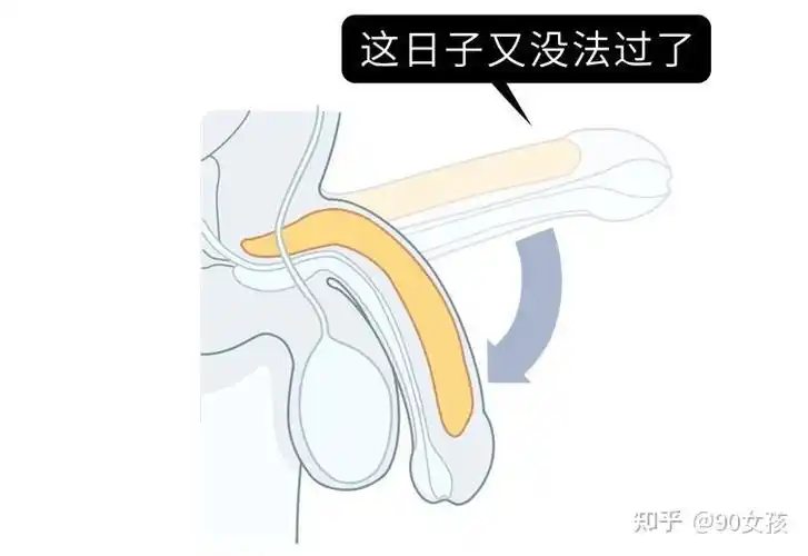 海绵体胀大会快速地充血当男生的丁丁受到一定刺激后阳痿阳痿≠早泄但