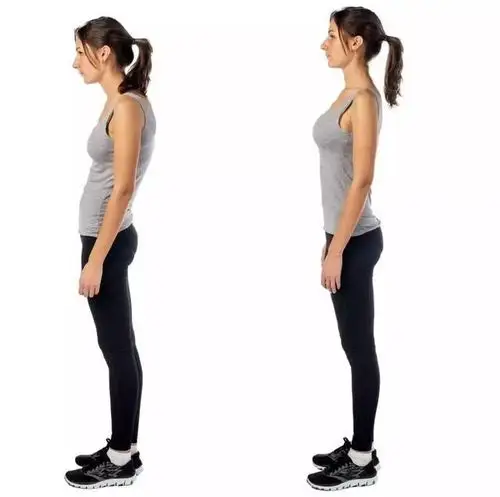 最难看的不是腿短,而是膝关节超伸!