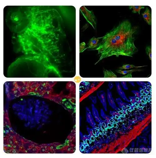 实验室技能小课堂如何得到一张好的免疫荧光图片
