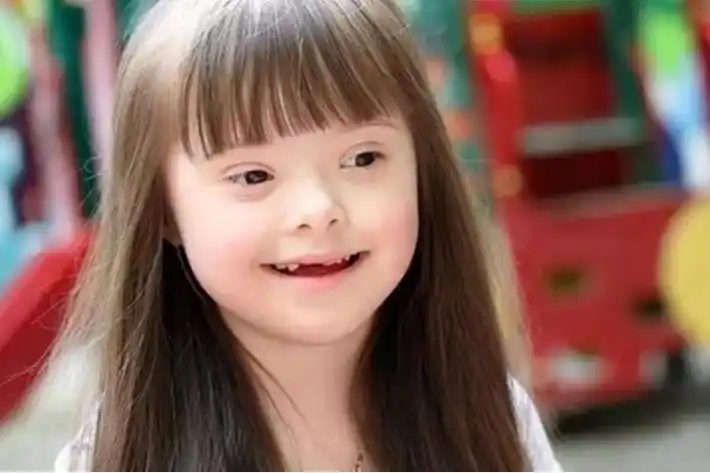 唐氏症儿童语言沟通问题与对策