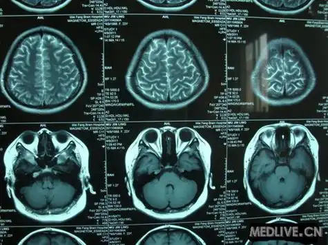 2 楼关注站内信玻璃房子2011-04-26 10:14好现给予鲁米那钠0.