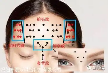 微整量子技术怎么代理代理费多少