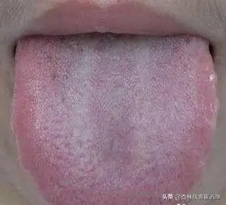 肝郁吃柴胡疏肝丸不管用?医生教你区分柴胡疏肝丸与加味逍遥丸