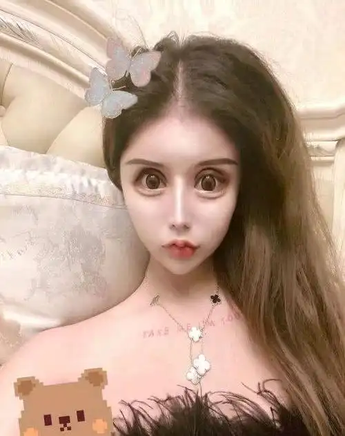 13岁开始整容,三年花了上百万