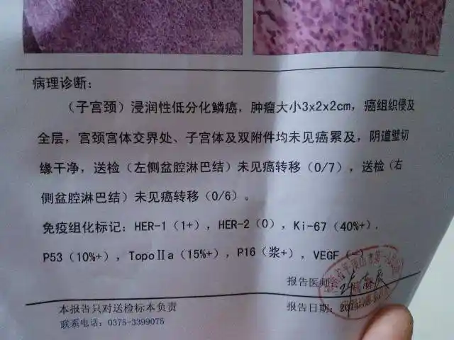 求分析宫颈癌诊断结果