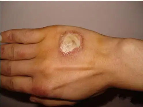 伴随着我们童年的这东西你认识吗,它的作用可不止一