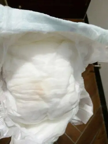 五个月婴儿尿有点粉色是什么原因啊!附图_百度宝宝知道