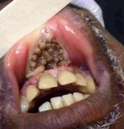 史上最恶心的图片 莲蓬乳/空手指超恶心图片合集(慎入) - 吐客网