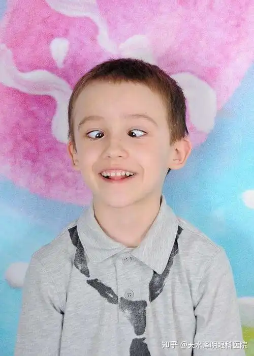 别让"斗鸡眼"毁了孩子一生!