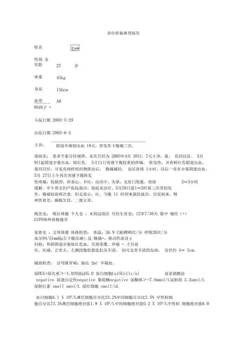 异位妊娠典型病历