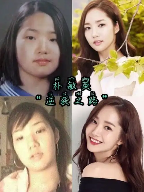 但是论整容最成功的艺人,当属她——韩剧《城市猎人》的女主朴敏英.